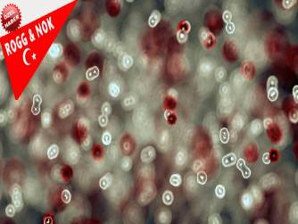 Cessur Demirali Gürsu:  Düşünmek ve fikir üretmek için işte evde kalmanın yararları? Coronavirus belirtileri, Aloo  dünyadan Türkiye'ye! 