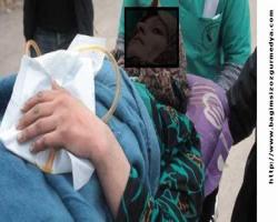 Halep'ten Hatay'a gelen yaralı sayısı 117 oldu, Halep'te hardal gazı kullandı... 