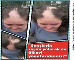 Ülkeyi saç yolarak mı yöneteceksiniz?