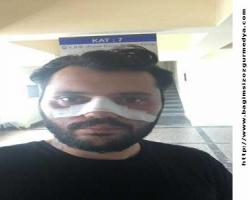 Burnu kırılan gencin hesabını soruldu mu?