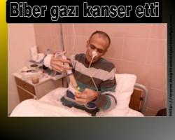 Biber gazı kanser etti