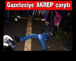 Bizlere hep olur; Gazeteciye 'AKREP' çarptı