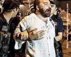 Çok ama çok Basit bir yaralanma, kovuşturmaya yer yok!